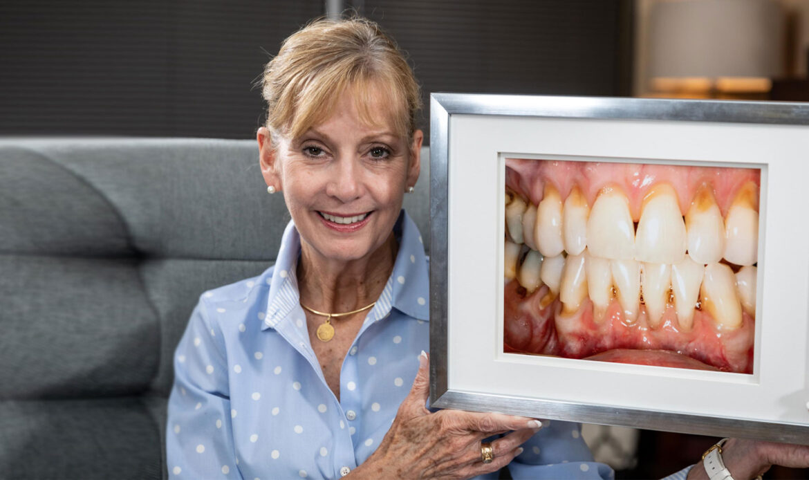 Dr. Friedberg patient holding smile transformation photo after all-on-x implants treatment