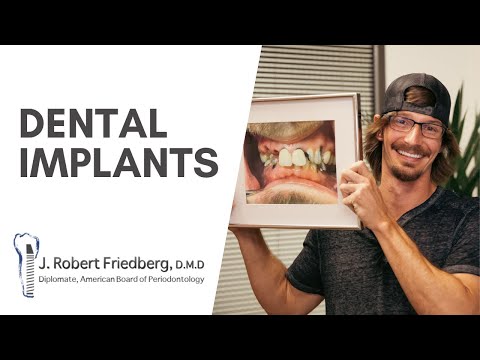 Logan - Lower All-On-4 Upper Single Implants