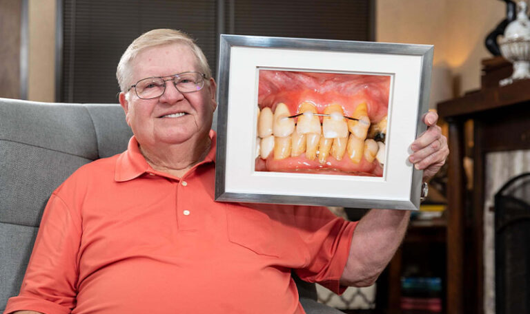 Smiling senior man holding a framed photo of his dental transformation after All-on-4 dental implants