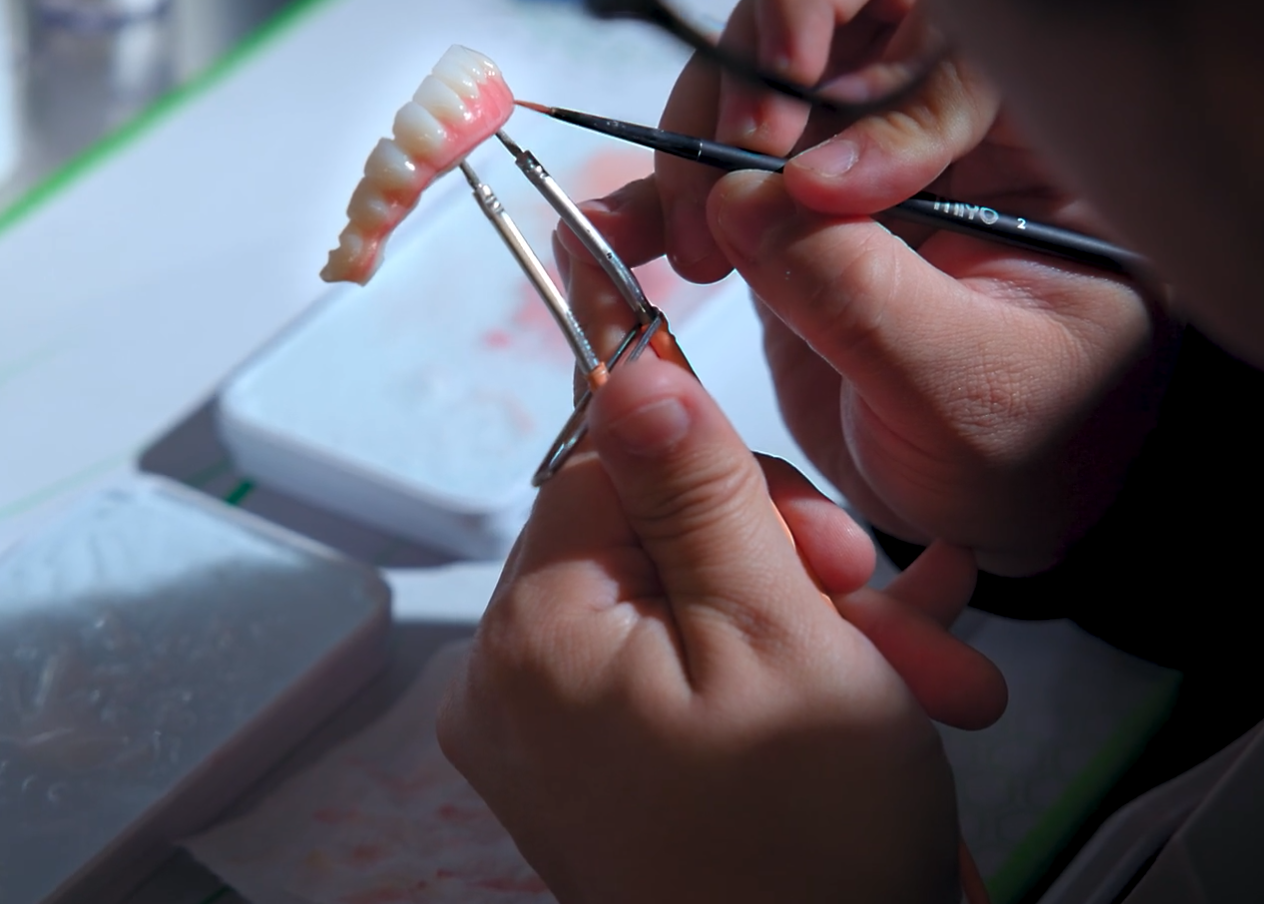 All on x dental implants being handmade. Using medical tongs to hold the teeth, the doctor paints the teeth to look natural.