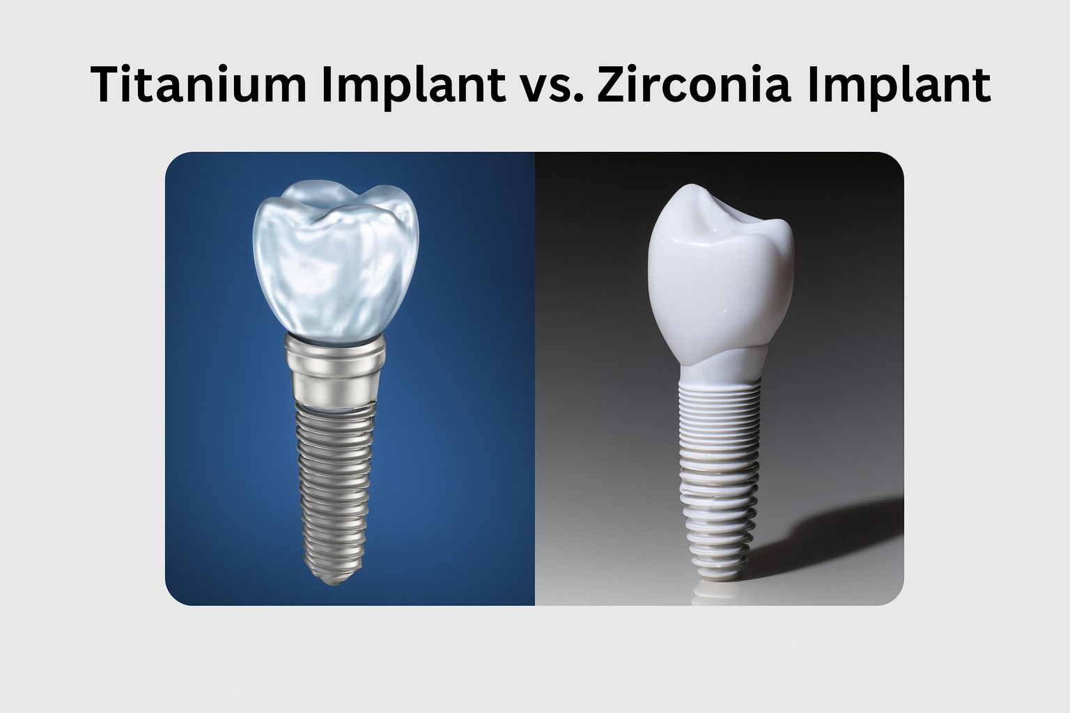 Zirconia vs Titanium Implants comparison in Houston