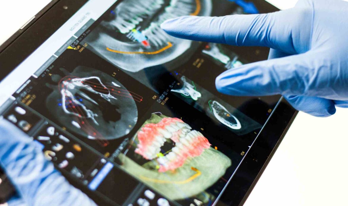 Dental implants Houston TX 3D scan and digital planning on tablet