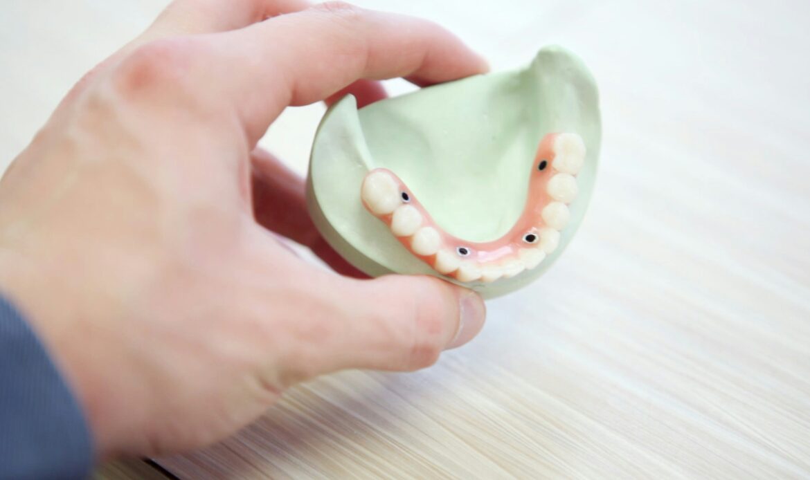 teeth implants near me dental model showing implant placement process in Houston
