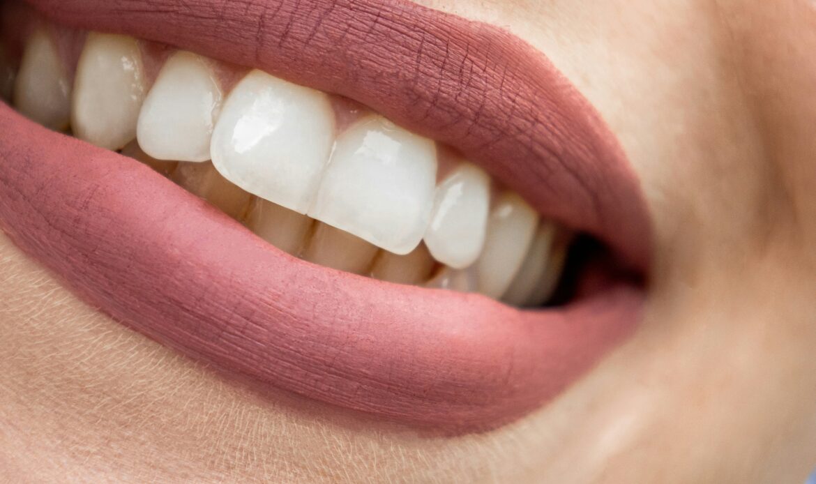 All-on-4 dental implants Houston realistic illustration