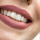 All-on-4 dental implants Houston realistic illustration