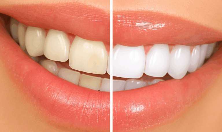 Zoom Whitening before and after results at Dr. Friedberg & Associates showing yellow teeth on the left and white teeth on the right.