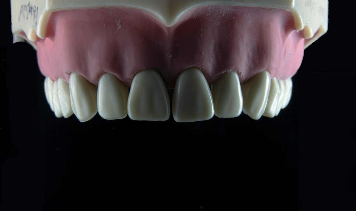 close-up showing dental implant failure affecting front teeth