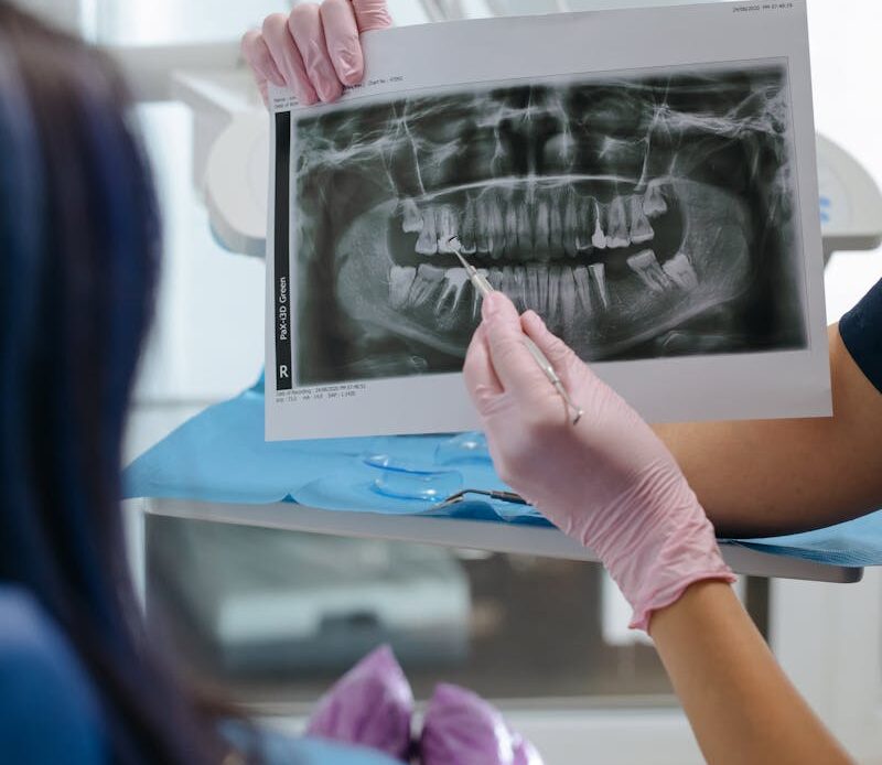 Dentist reviewing dental X-ray with visible bone loss linked to gum disease tooth loss.