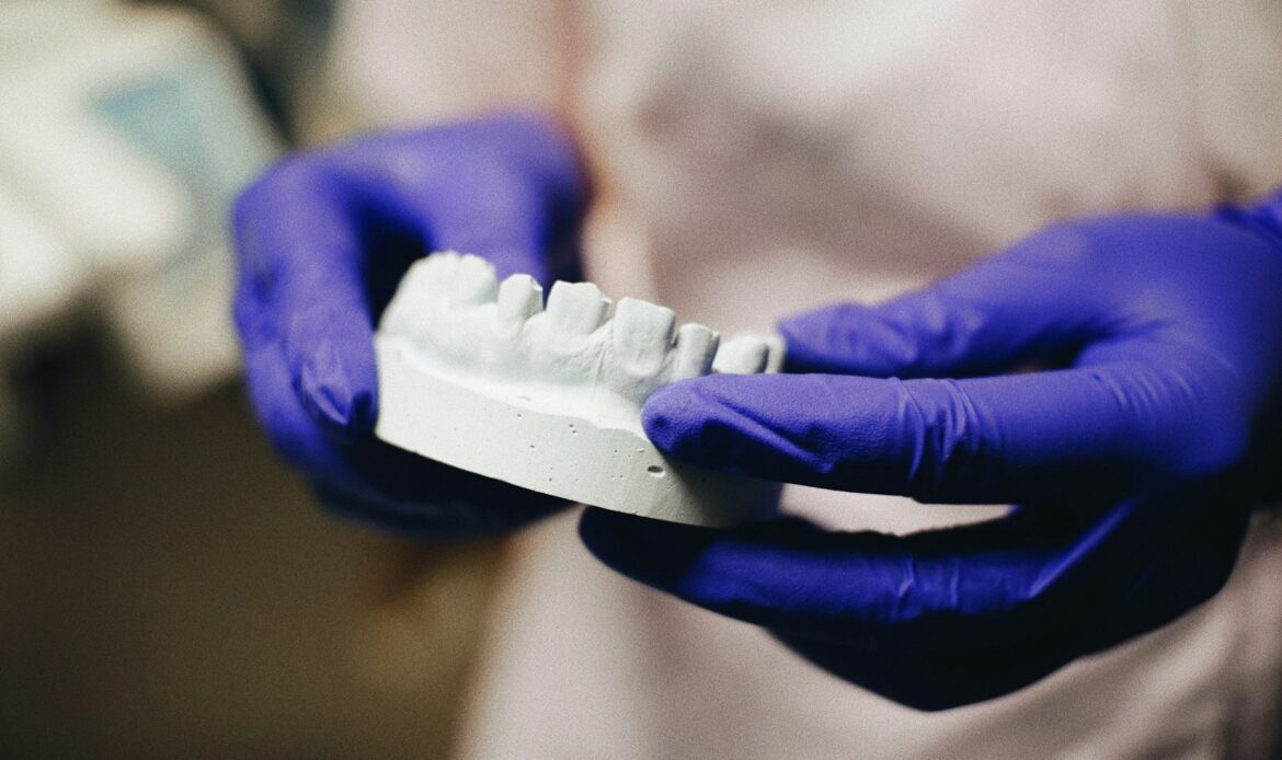 failed dental implant model held by dentist wearing gloves