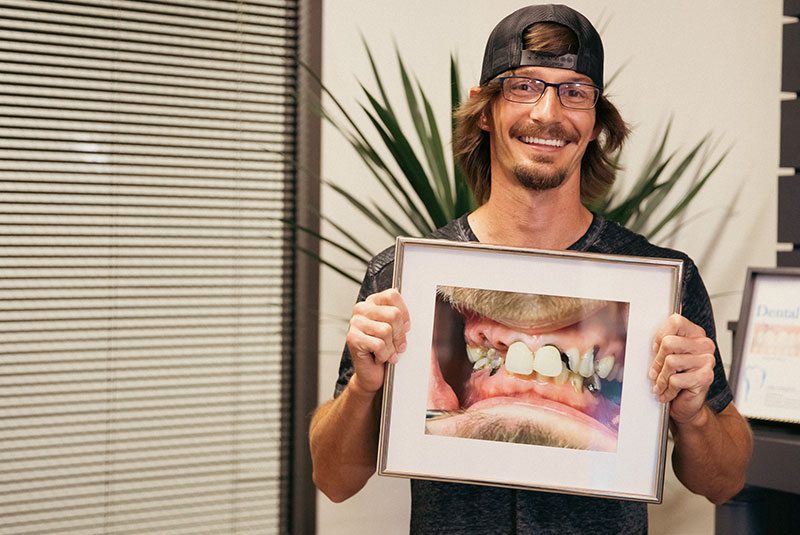 implant cost Houston consultation dental implant pricing discussion