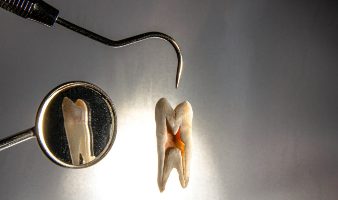can a tooth be saved dentist tools for tooth extraction or restoration