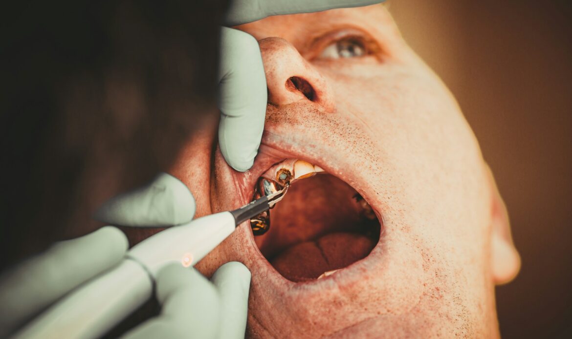 missing tooth replacement consultation during dental examination