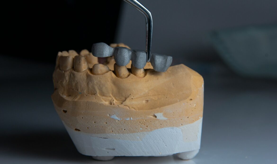 Dental implant specialist Houston treatment planning model