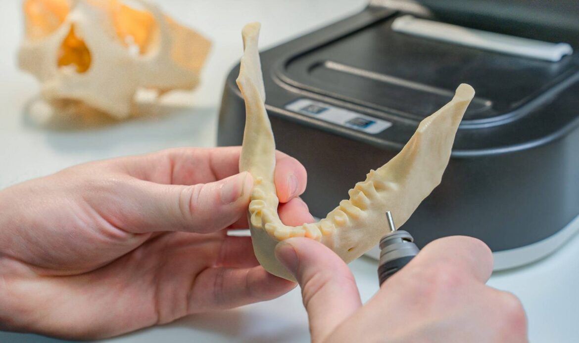 dental implants candidates evaluation with jaw model Houston periodontist