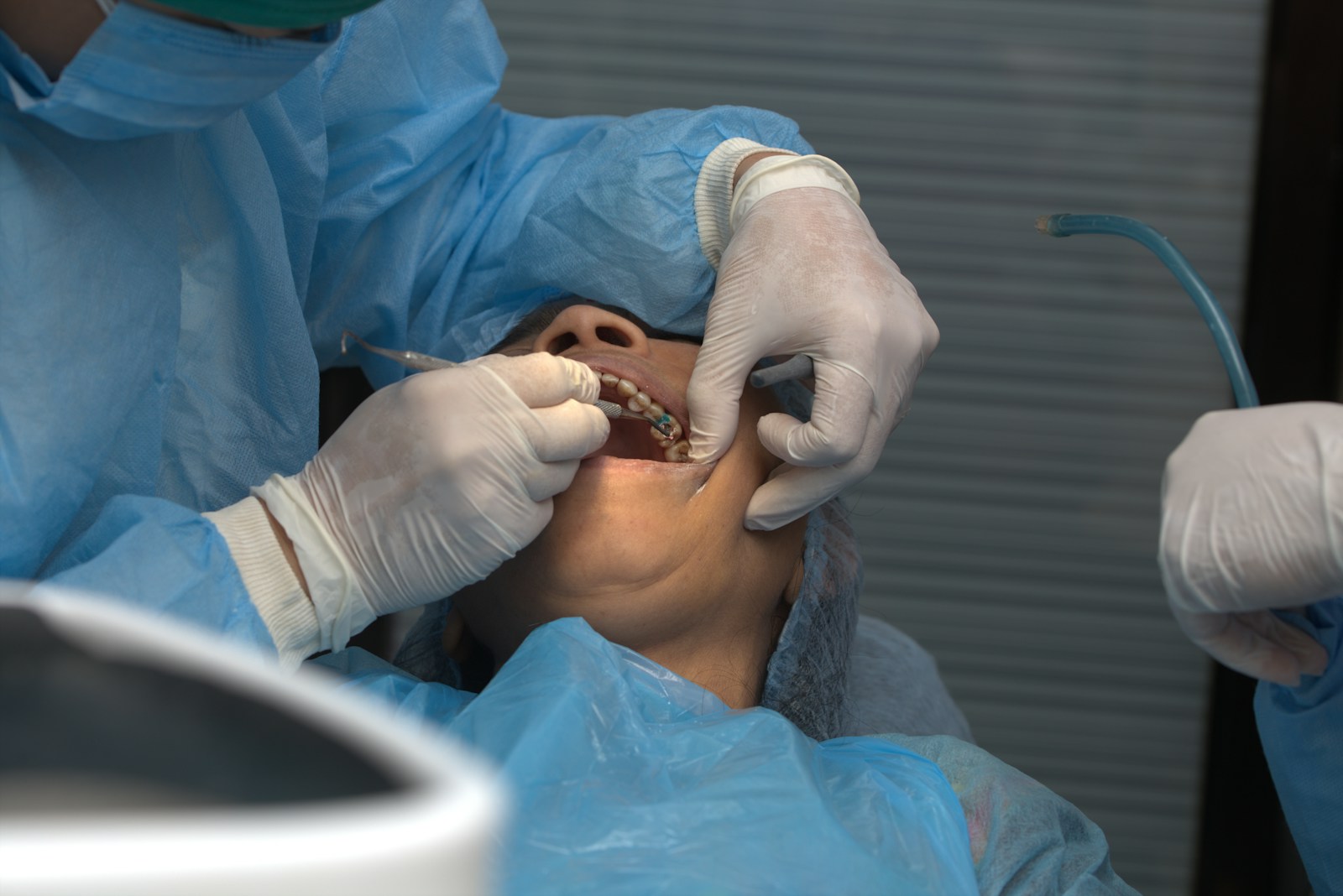 Periodontist performing crown lengthening surgery on a patient in Houston