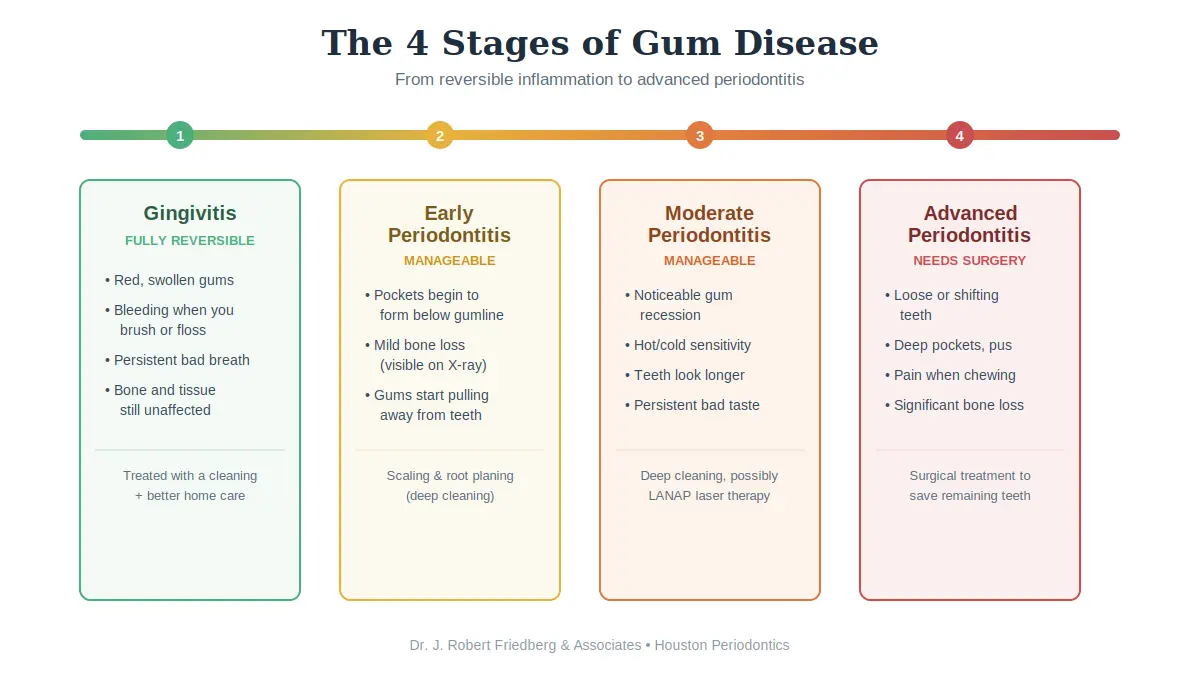 The 4 stages of gum disease, from gingivitis to advanced periodontitis
